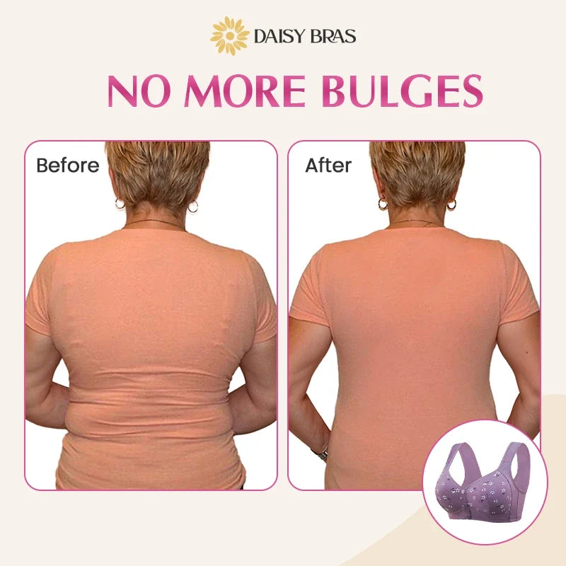 LAST DAY SALE 80% OFF - Comfortable & Convenient Front Button Bra